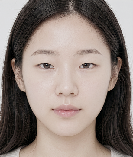 눈밑지방 재건술 시술 전